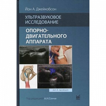 Ультразвуковое исследование опорно-двигательного аппарата Ультразвуковое исследование опорно-двигательного аппарата