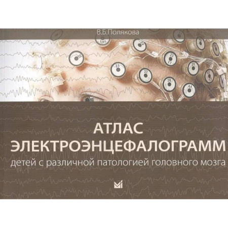 Неврология, книга Атлас электроэнцефалограмм детей с различной патологией головного мозга купить по скидке