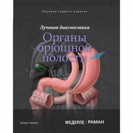 Внутренние болезни. Диагностика, книга Лучевая диагностика. Органы брюшной полости купить по скидке