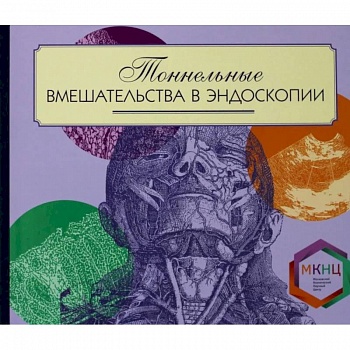 Тоннельные вмешательства в эндоскопии Тоннельные вмешательства в эндоскопии
