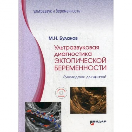 УЗИ. ЭКГ. Томография. Рентген, книга Ультразвуковая диагностика эктопической беременности купить по скидке