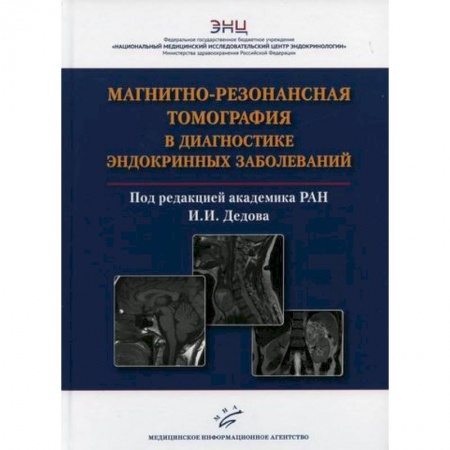 УЗИ. ЭКГ. Томография. Рентген, книга Магнитно-резонансная томография в диагностике эндокринных заболеваний купить по скидке