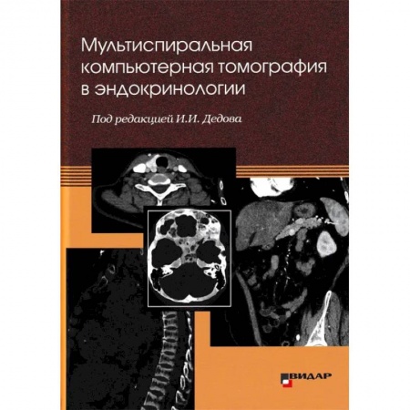 УЗИ. ЭКГ. Томография. Рентген, книга Мультиспиральная компьютерная томография в эндокринологии купить по скидке