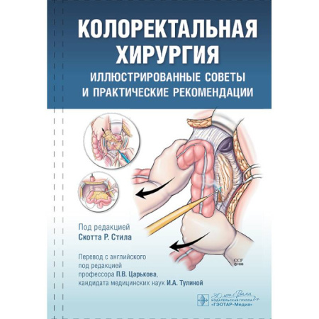 Медицинские энциклопедии и справочники, книга Колоректальная хирургия. Иллюстрированные советы и практические рекомендации купить по скидке