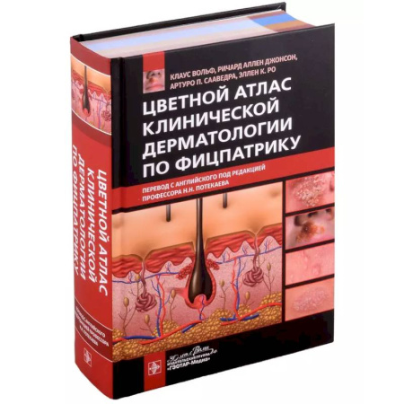 Кожные и венерические болезни, книга Цветной атлас клинической дерматологии по Фицпатрику купить по скидке