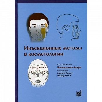 Инъекционные методы в косметологии Инъекционные методы в косметологии