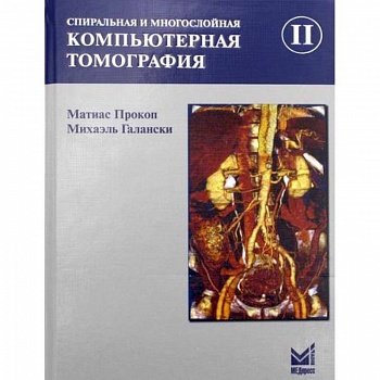 Спиральная и многослойная компьютерная томография Спиральная и многослойная компьютерная томография