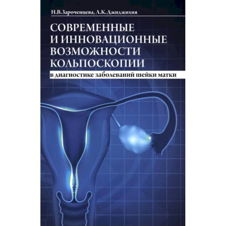 Медицинские энциклопедии и справочники, книга Современные и инновационные возможности кольпоскопии в диагностике заболеваний шейки матки. купить по скидке