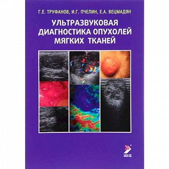 Ультразвуковая диагностика опухолей мягких тканей Ультразвуковая диагностика опухолей мягких тканей
