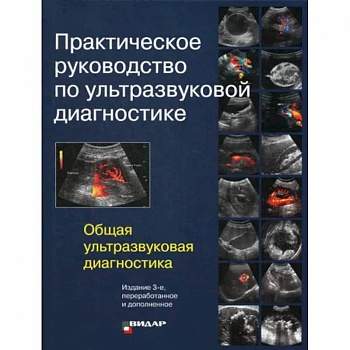 Практическое руководство по ультразвуковой диагностике. Общая ультразвуковая диагностика Практическое руководство по ультразвуковой диагностике. Общая ультразвуковая диагностика