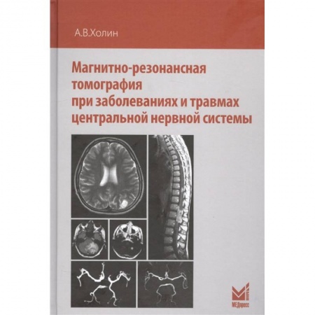 УЗИ. ЭКГ. Томография. Рентген, книга Магнитно-резонансная томография при заболеваниях и травмах центральной нервной системы купить по скидке