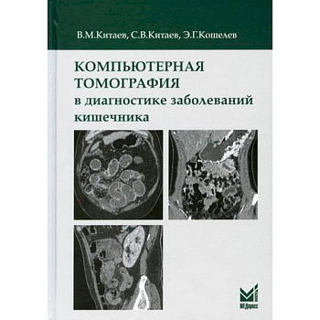 Компьютерная томография в диагностике заболеваний кишечника Компьютерная томография в диагностике заболеваний кишечника